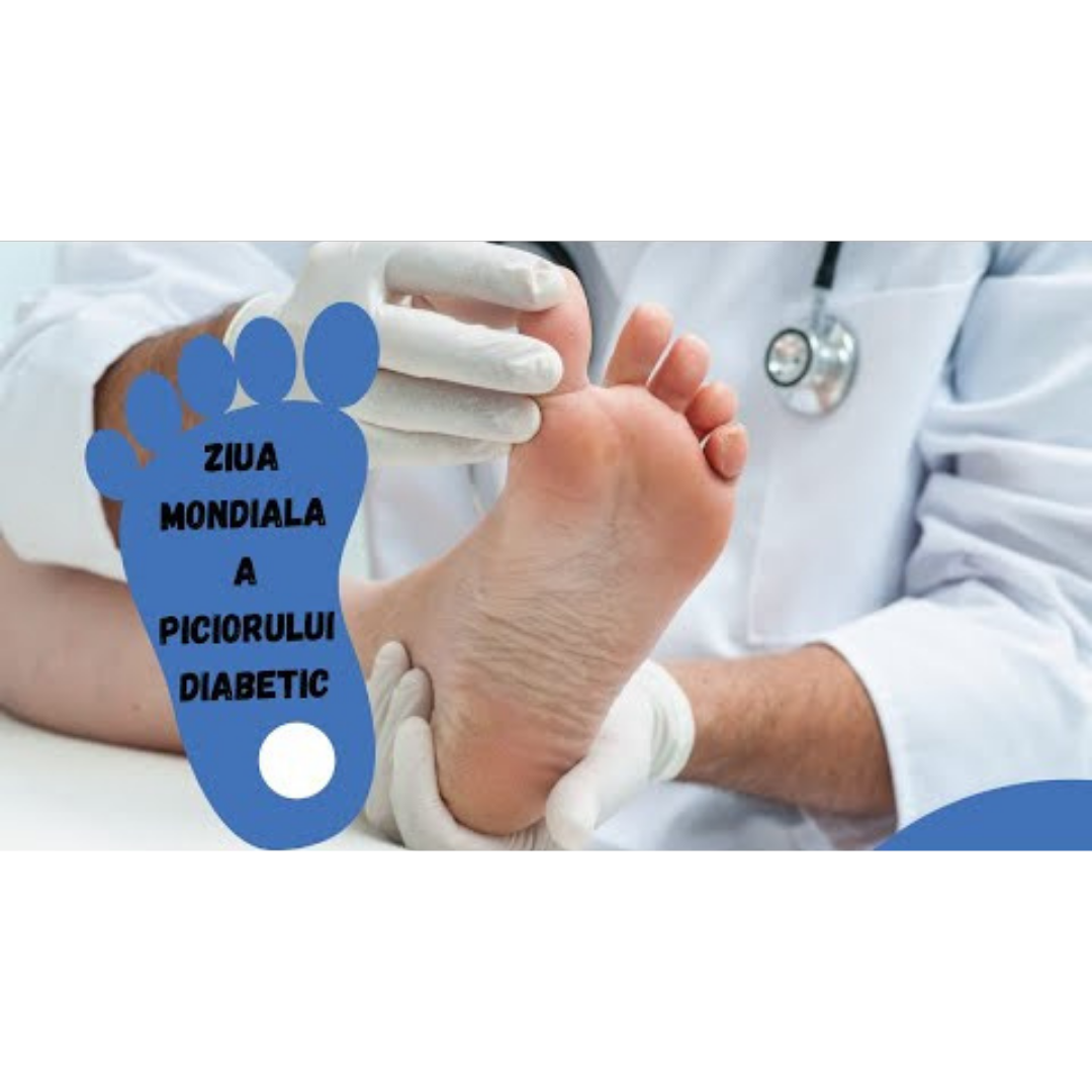 Diabetul Zaharat: 10 Sfaturi ca sa NU Ajungi la Amputatie Diabetul Zaharat: 10 Sfaturi ca sa NU Ajungi la Amputatie