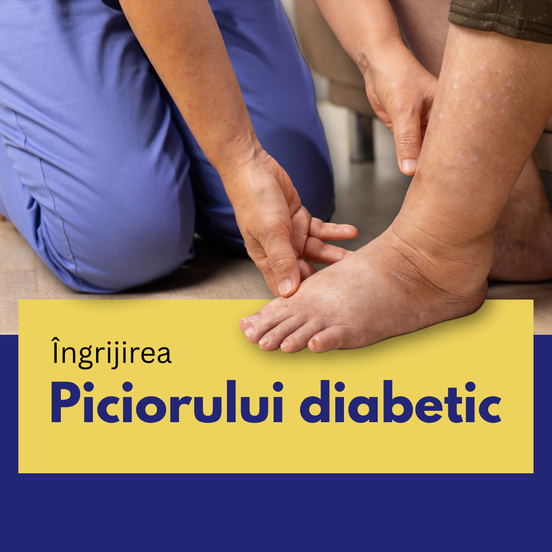 Piciorul diabetic - ce să știe persoanele cu DIABET