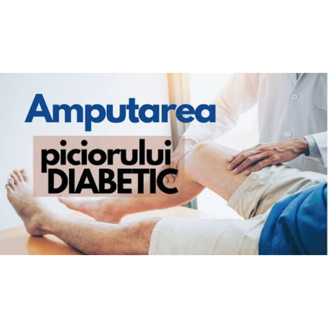 Amputarea piciorului diabetic